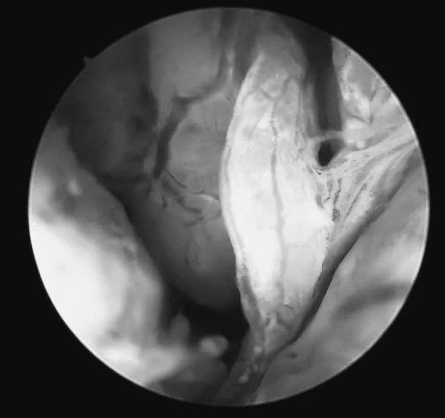 Rong kinh kéo dài và kết cục không mong muốn