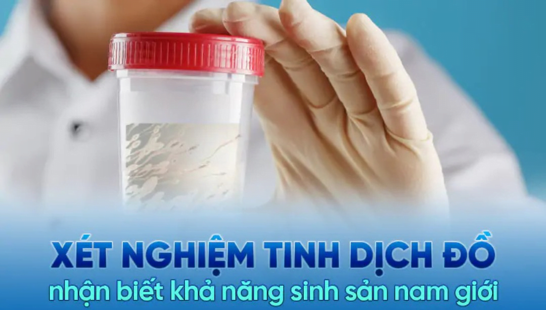 Xét nghiệm tinh dịch đồ đánh giá khả năng sinh sản cho nam giới